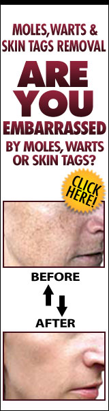 Moles, Warts and Skin Tags Removal