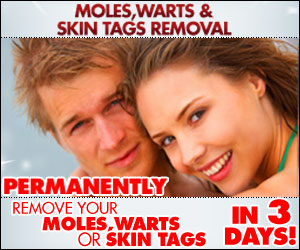 Moles, Warts and Skin Tags Removal